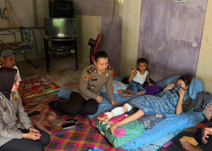 Ngeri! Cuci Pakaian di Sungai, Remaja Putri di Tanggamus Diterkam Buaya hingga Kaki Robek 20 Sentimeter